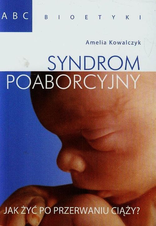 Image of Syndrom poaborcyjny Jak żyć po przerwaniu ciąży?