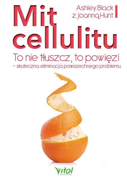 Image of Mit cellulitu