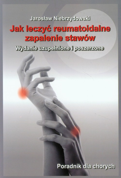 Image of Jak leczyć reumatoidalne zapalenie stawów Poradnik dla chorych
