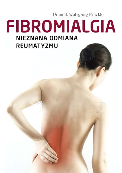 Image of Fibromialgia Nieznana odmiana reumatyzmu