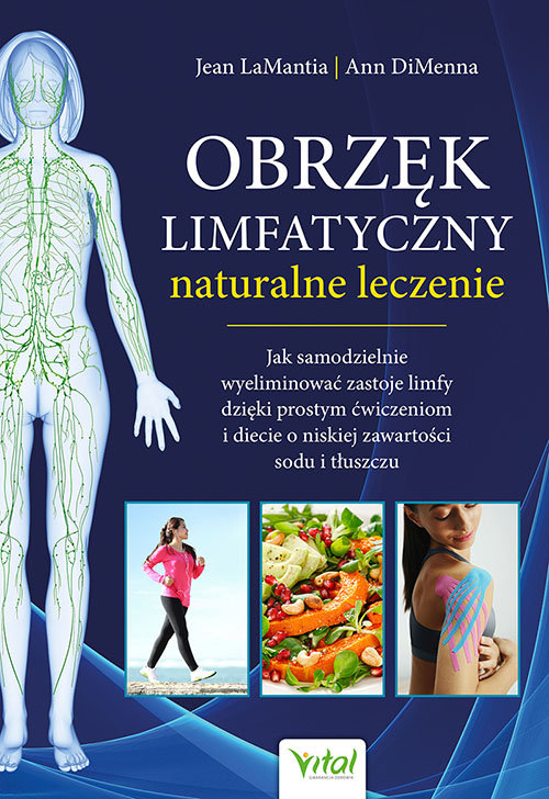 Image of Obrzęk limfatyczny naturalne leczenie