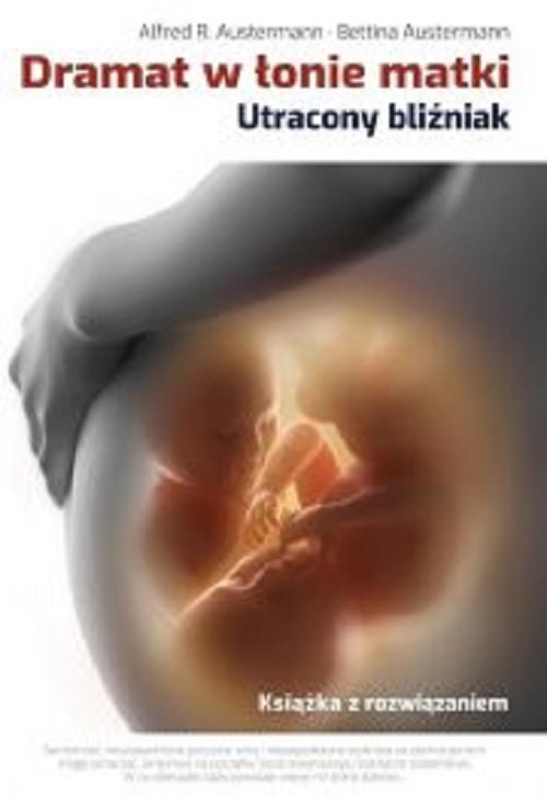 Image of Dramat w łonie matki Utracony bliźniak