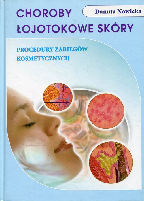 Image of Choroby łojotokowe skóry Procedury zabiegów kosmetycznych