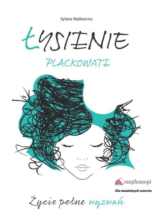 Image of Łysienie plackowate Życie pełne wyzwań