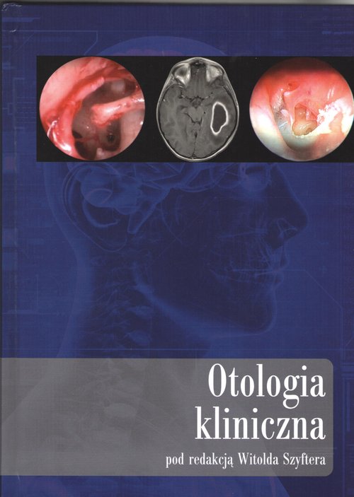 Image of Otologia kliniczna