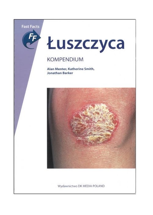 Image of Łuszczyca Kompendium