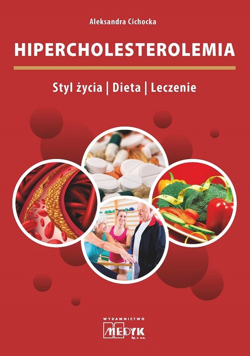 Image of Hipercholesterolemia Styl życia Dieta Leczenie