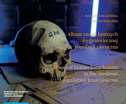 Image of Album zmian kostnych średniowiecznej populacji z Gruczna Album of human bone lesions in the medieva